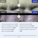 Sérum Medicube Exosome Shot 7500 Microagulhamento